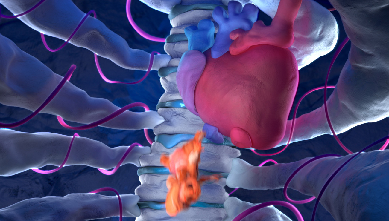 Digestion, Projets Piktura